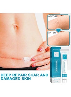 West&Month Scar Repair Cream Lightening Hyperplasia Pregnancy Surgery Burn Scar Skin Repair Scar Cream 20g  - Image 5
