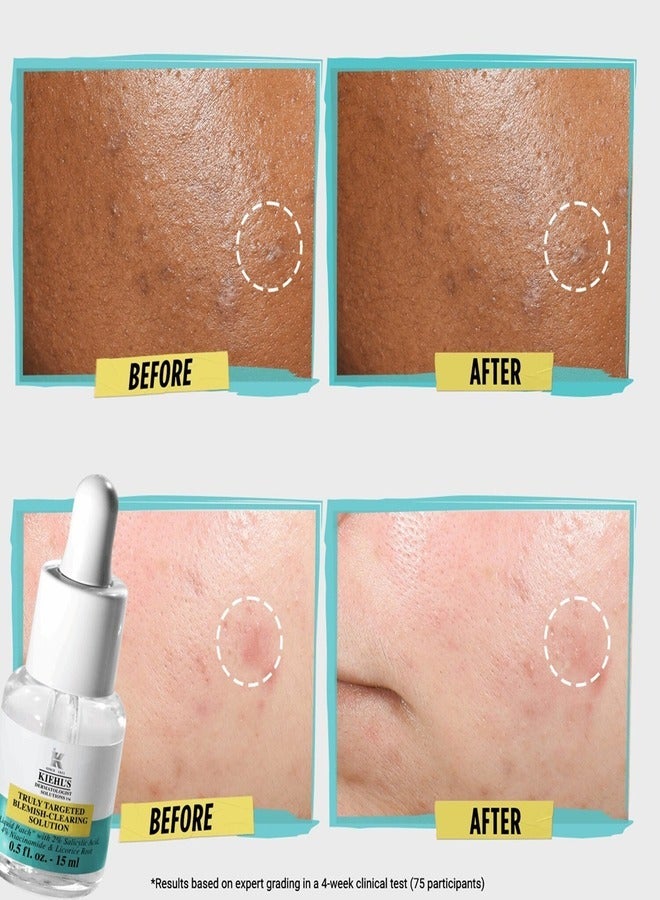 Kiehls KIEHL'S Truly Targeted Blemish-Clearing Solution with Salicylic Acid - 15ml | Spot Treatment for Clear Skin  - Image 3