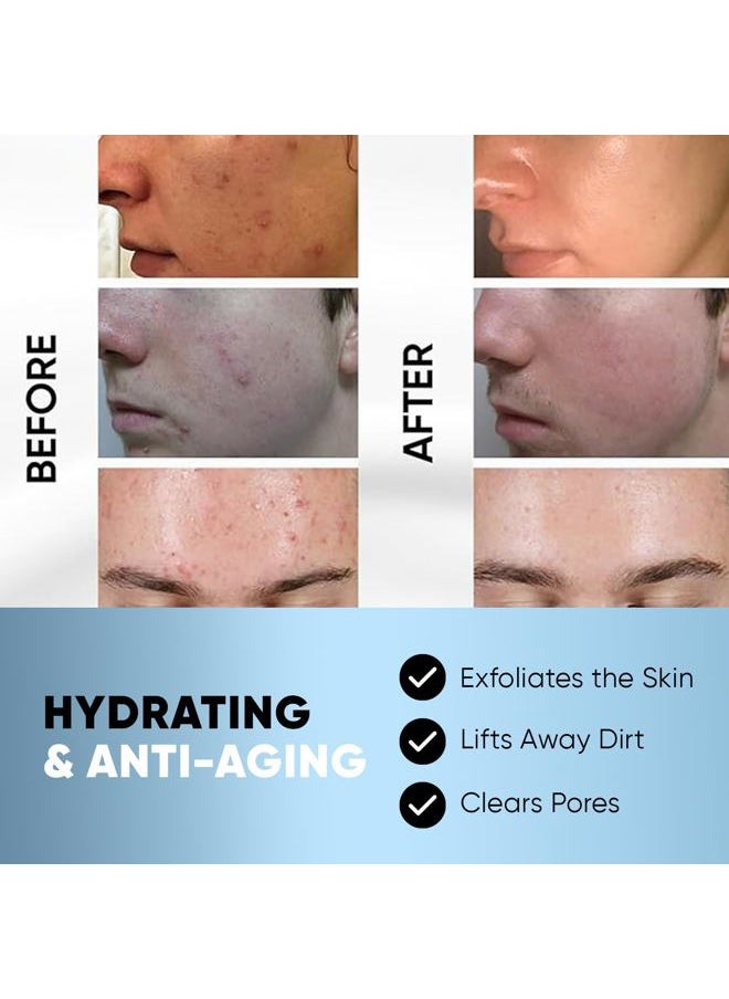 Estetist - Salicylic and Glycolic Acid Facial Cleansing Pads, Hydrating Acne Pads with Natural Extracts, Exfoliating Face Cleansing Pads for Men and Women, Acne Care Wipes, 60 Count - Image 1