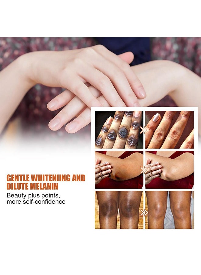 EELHOE Papaya Seed Oil-Therapy Drops Whitening Hand Knuckle Glow Serum, Restoring Hand Treatment, Moisturizing, Exfoliates and Reduces Unbalanced Pigmentation, for Removing Dark Knuckle Elbow, Brighter, Firm  - Image 3