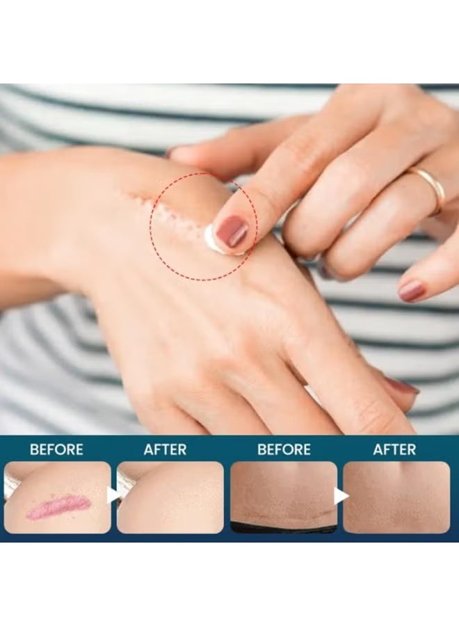 Sumifun Lavender Scar Removal Cream – Smooth & Renew Your Skin - Image 4
