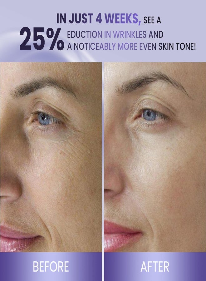 ABERA Belani Retinol Cream for Face, Facial Moisturizer with Collagen Cream and Hyaluronic Acid, Anti-Wrinkle Reduce Fine Lines, Night Anti-Aging For Women (1.01 Fl Oz) (1 Box + 2 Eye Patches) - Image 3