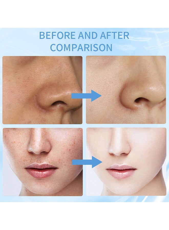 QANZIRE Vitamin B3 Niacinamide Serum, Niacinamide Face Serum For Women & Men, Skin Brightening Serum Face Care, Anti Aging Serum For Face, Dark Spot Remover Serum, Hydrating Serum, Even Skin Tone 30ml - Image 4