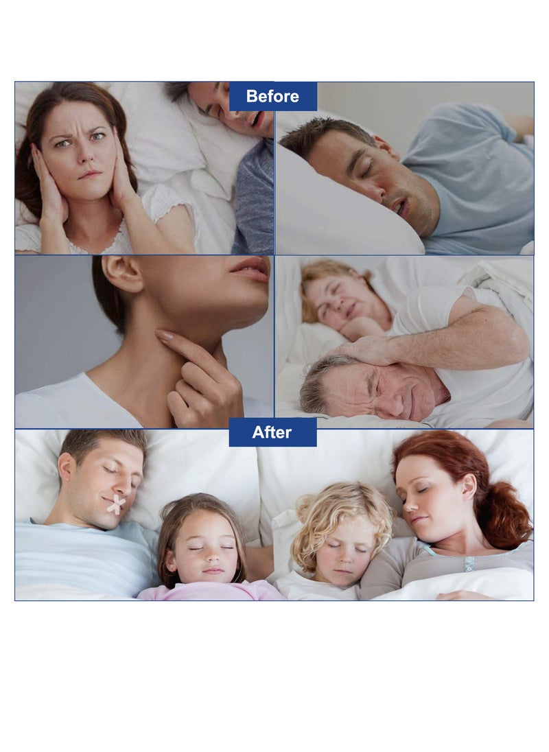 Sefudun - Sleeping Strips 120 Pieces Mouth Tape Anti-Snoring Device for Sleeping for Better Nose Breathing for Breathing Better Breathing Snoring Against Snoring Less Mouth Breathing - Image 1