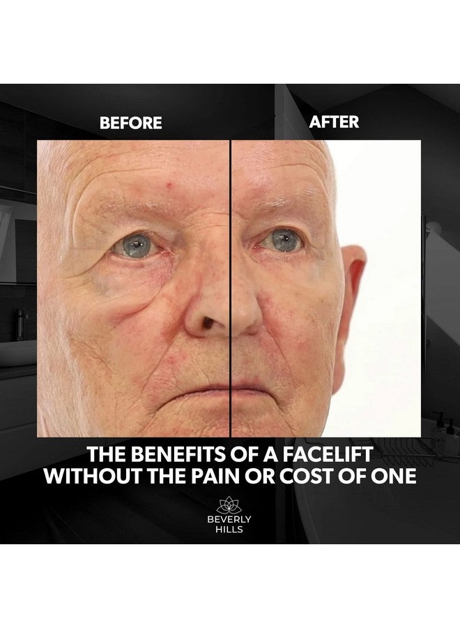 Beverly Hills Mens Instant Facelift and Eye Serum Treatment for Dark Circles, Puffy Eyes, and Wrinkles - Image 3