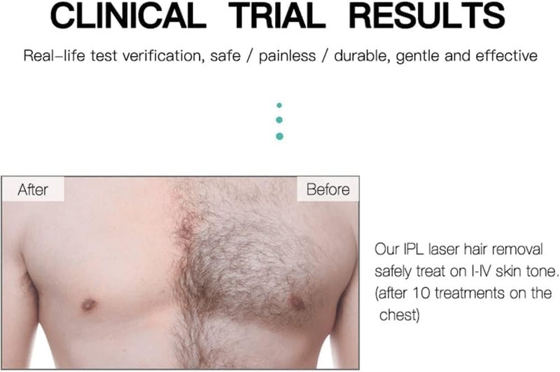 LEEHELTON IPL Hair Removal Handset Laser Hair Removal Machine for Permanent Painless Lazer Hair Removing Epilator men and women bikini armpit bikini pubic hair removals - Image 5