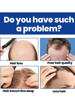 East Moon Man Hair Growth Spray ，Dense Growth Hair，Chest Hair ，Beard Hair Growth  Nutrient Solution，Alopecia Hair Growth Treatment for Sparse Hair ﻿,Minoxidil Promote Hair Follicle Growth Trigger New Hair Growth  - Image 5