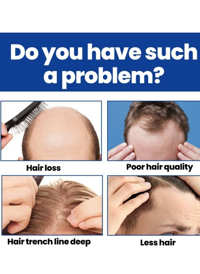 East Moon - Man Hair Growth Spray ，Dense Growth Hair，Chest Hair ，Beard Hair Growth  Nutrient Solution，Alopecia Hair Growth Treatment for Sparse Hair ﻿,Minoxidil Promote Hair Follicle Growth Trigger New Hair Growth - Image 1