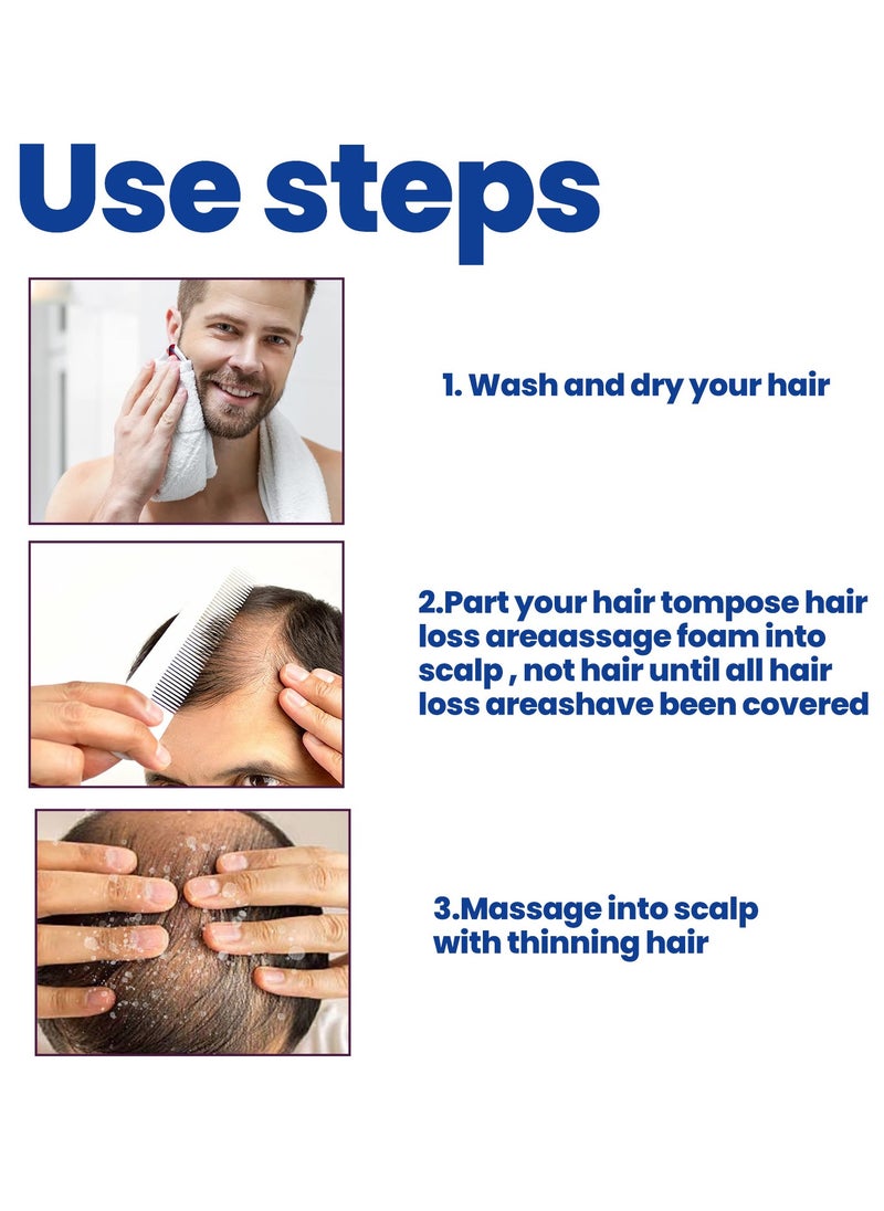 East Moon - Man Hair Growth Spray ，Dense Growth Hair，Chest Hair ，Beard Hair Growth  Nutrient Solution，Alopecia Hair Growth Treatment for Sparse Hair ﻿,Minoxidil Promote Hair Follicle Growth Trigger New Hair Growth - Image 1