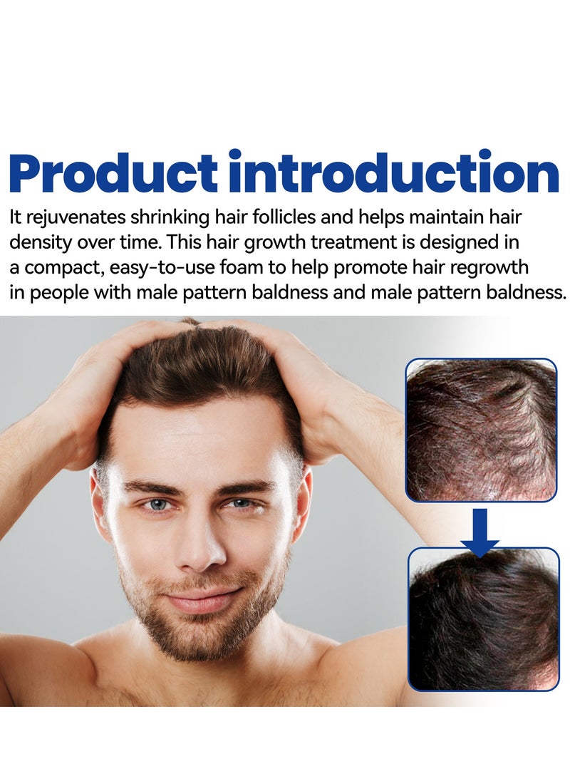 East Moon - Man Hair Growth Spray ，Dense Growth Hair，Chest Hair ，Beard Hair Growth  Nutrient Solution，Alopecia Hair Growth Treatment for Sparse Hair ﻿,Minoxidil Promote Hair Follicle Growth Trigger New Hair Growth - Image 1