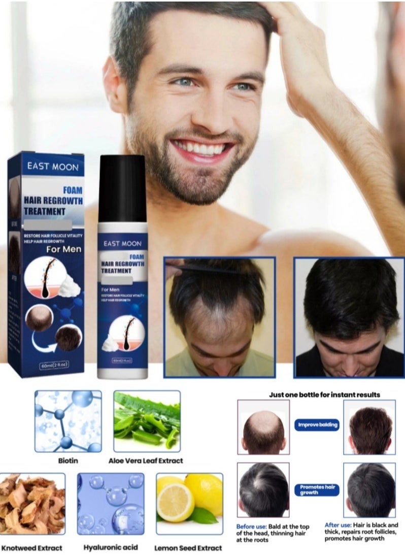 East Moon - Man Hair Growth Spray ，Dense Growth Hair，Chest Hair ，Beard Hair Growth  Nutrient Solution，Alopecia Hair Growth Treatment for Sparse Hair ﻿,Minoxidil Promote Hair Follicle Growth Trigger New Hair Growth - Image 1