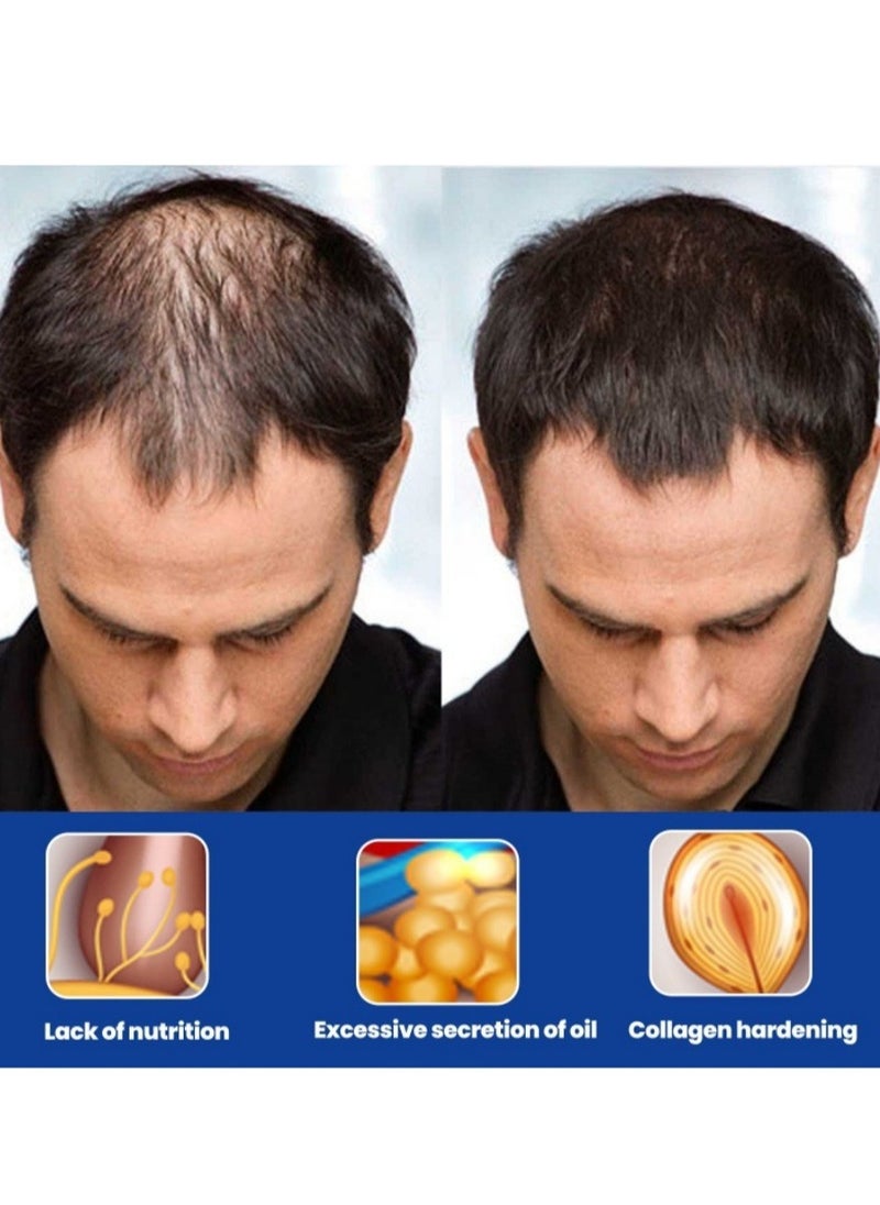 East Moon - Man Hair Growth Spray ，Dense Growth Hair，Chest Hair ，Beard Hair Growth  Nutrient Solution，Alopecia Hair Growth Treatment for Sparse Hair ﻿,Minoxidil Promote Hair Follicle Growth Trigger New Hair Growth - Image 1