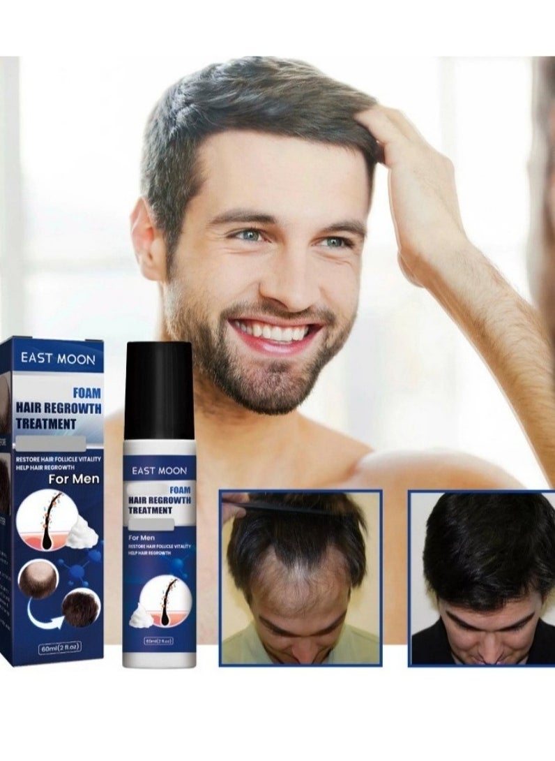 East Moon - Man Hair Growth Spray ，Dense Growth Hair，Chest Hair ，Beard Hair Growth  Nutrient Solution，Alopecia Hair Growth Treatment for Sparse Hair ﻿,Minoxidil Promote Hair Follicle Growth Trigger New Hair Growth - Image 1