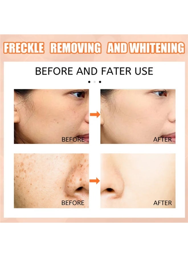 EELHOE Whitening Freckle Removal Cream Vitamin C Whitening Anti Freckle Cream Pen Effectively Remove the Freckles Triple Action Blemish Skin Corrector Serum Instant Blemish Removal Gel Acne Spots Removal Cream 15ml - Image 4