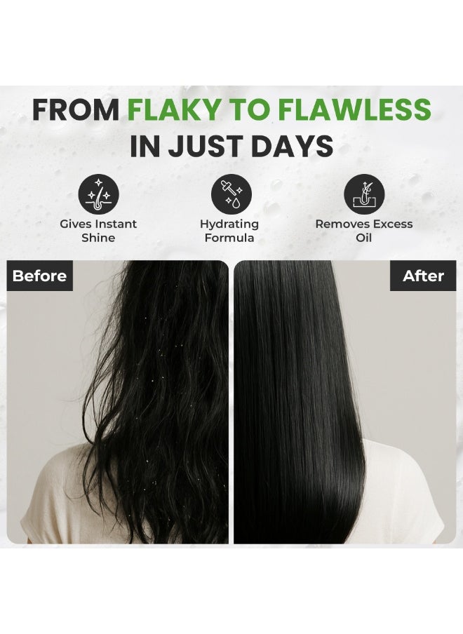 Anti Dandruff Shampoo for Men & Women | Charcoal Detox Formula for Itchy Scalp Relief, Flake Control & Scalp Cooling | Daily Use Shampoo for All Hair Types | Fights Dandruff, Soothes Scalp & Prevents Dryness | Paraben-Free & Gentle | 600ml