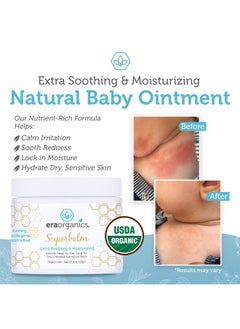 Era Organics Healing Ointment for Babies - USDA Certified Organic Natural Gentle Moisturizer for Sensitive Skin Prone To Baby Eczema, Cradle Cap (Infant Seborrheic Dermatitis), Rashes & Hives (4 oz.)  - Image 4