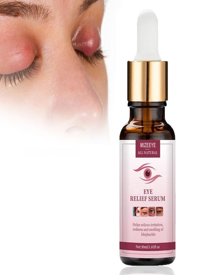MIZEEYE Chalazion Eye Treatment For Blepharitis, 30ml Moisturize Eyelids Serum and Chalazion Remover, Gentle Under Eye Relief Serum For Dark Circles, Eye Bags, Puffiness. - Image 1