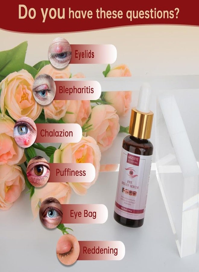 MIZEEYE Chalazion Eye Treatment For Blepharitis, 30ml Moisturize Eyelids Serum and Chalazion Remover, Gentle Under Eye Relief Serum For Dark Circles, Eye Bags, Puffiness. - Image 3