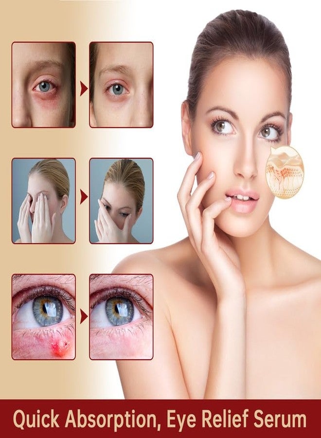 MIZEEYE Chalazion Eye Treatment For Blepharitis, 30ml Moisturize Eyelids Serum and Chalazion Remover, Gentle Under Eye Relief Serum For Dark Circles, Eye Bags, Puffiness. - Image 5