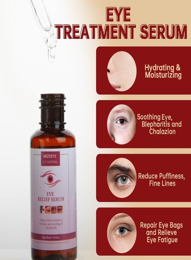 MIZEEYE Chalazion Eye Treatment For Blepharitis, 30ml Moisturize Eyelids Serum and Chalazion Remover, Gentle Under Eye Relief Serum For Dark Circles, Eye Bags, Puffiness. - Image 2