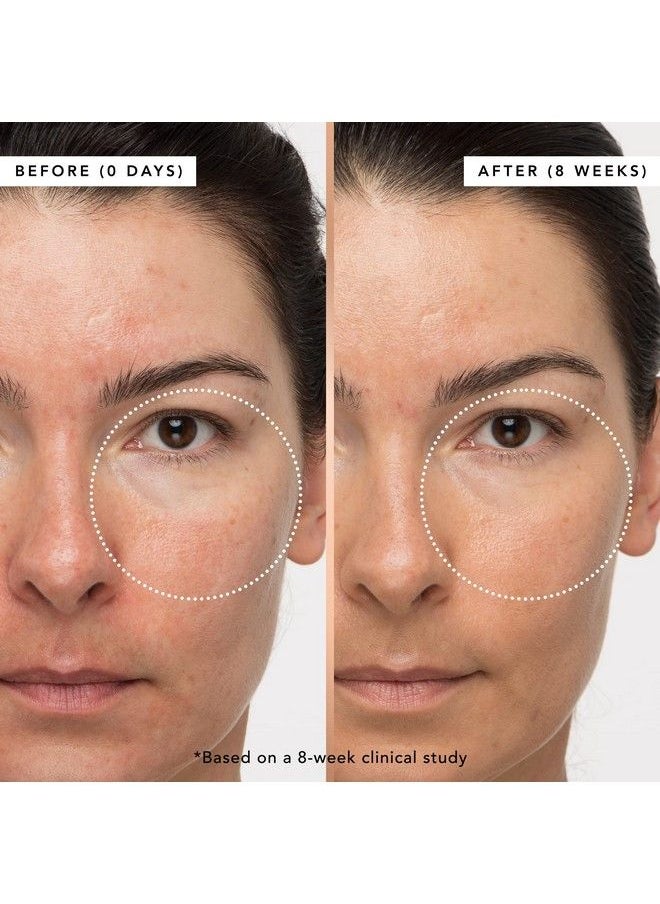 That Overnight Hustle Aha + Bha Resurfacer ; Gently Exfoliates Hydrates Brightens & Visibly Reduces Fine Lines And Wrinkles ; 1.0 Ounce