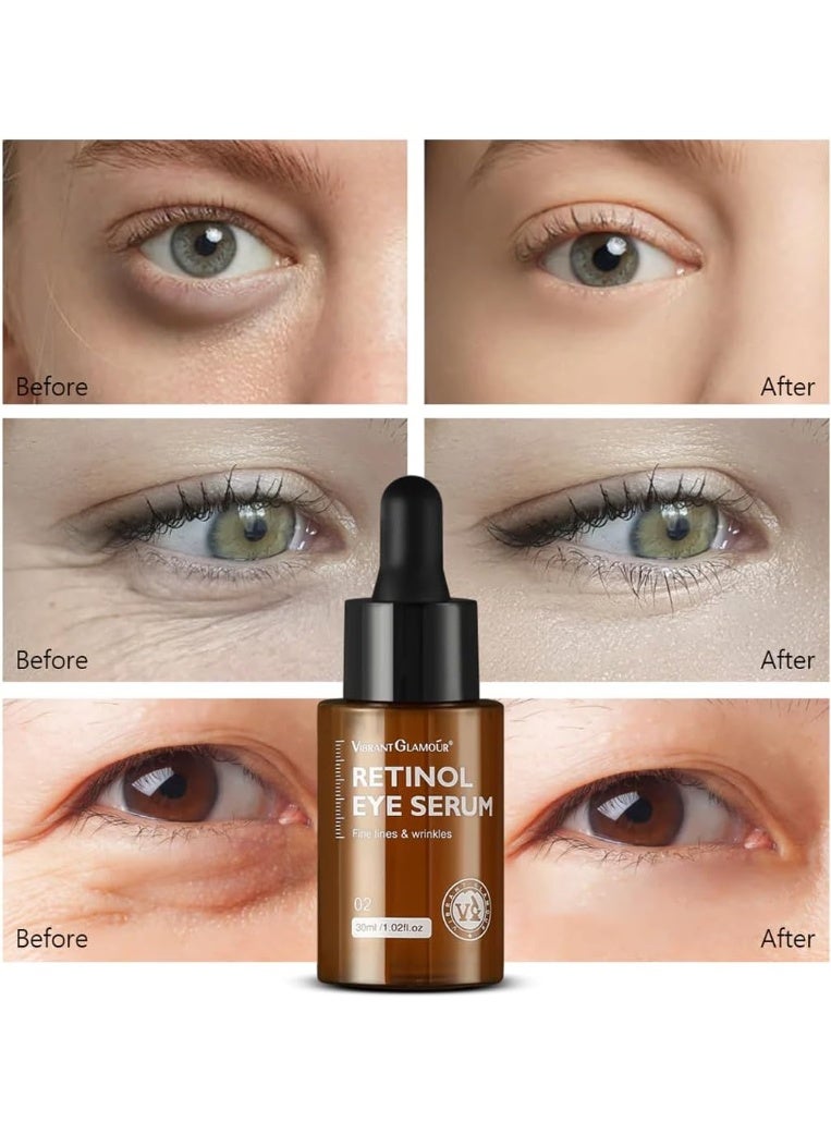 Vibrant Glamour Retinol Eye Serum Removes Dark Circles Fade Fine Lines Remove Eye Bags Anti-Wrinkle Anti-Aging Firming & Brighten Skin Retinol Arbutin Vitamin C & E Blended Eye Serum 30ml - Image 4