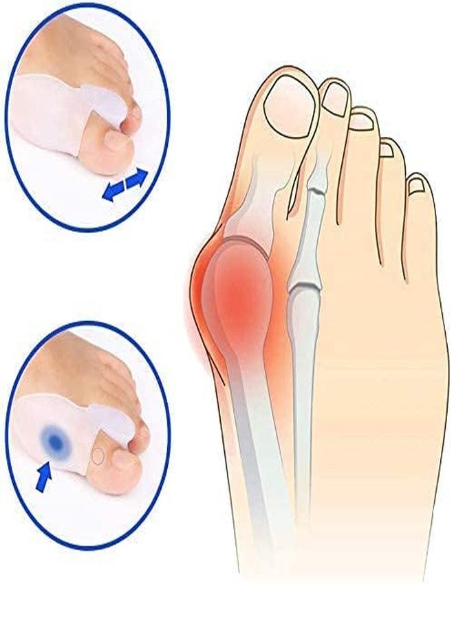 SUEFOR 2 PAIR (4 PCS) Bunion Cushion Protector Silicone Toe Separator Hallux Valgus Bunion Treatment Orthopedic Brace Pair (White) (set of 4) - Image 2