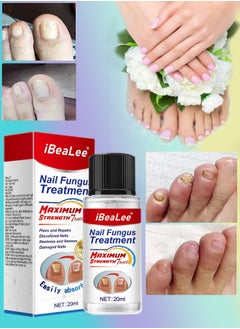 iBealee Nail Fungus treatment 7 Day Nail Repair Treatment Liquid for Damaged Toenails and Fingernails Fungal Nail Renewal Anti Fungus Nail Repair Smooth Moisturize Nail Reduce Discoloration Nail Serum 20ml  - Image 1