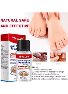 iBealee Nail Fungus treatment 7 Day Nail Repair Treatment Liquid for Damaged Toenails and Fingernails Fungal Nail Renewal Anti Fungus Nail Repair Smooth Moisturize Nail Reduce Discoloration Nail Serum 20ml  - Image 2