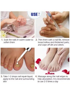 iBealee Nail Fungus treatment 7 Day Nail Repair Treatment Liquid for Damaged Toenails and Fingernails Fungal Nail Renewal Anti Fungus Nail Repair Smooth Moisturize Nail Reduce Discoloration Nail Serum 20ml  - Image 4