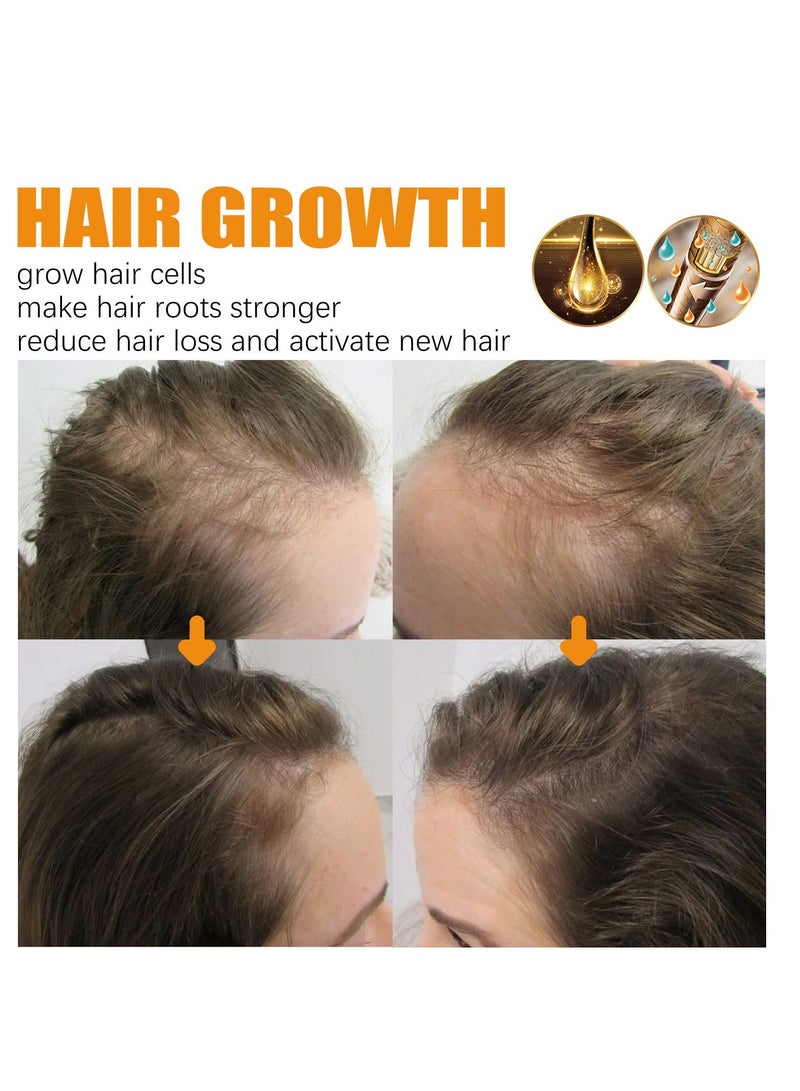 إيلهو مصل نمو الشعر بالبيوتين والخروع وزيت إكليل الجبل ، علاج طبيعي غني بالفيتامينات ل 50 مل أكثر سمكا - Image 2