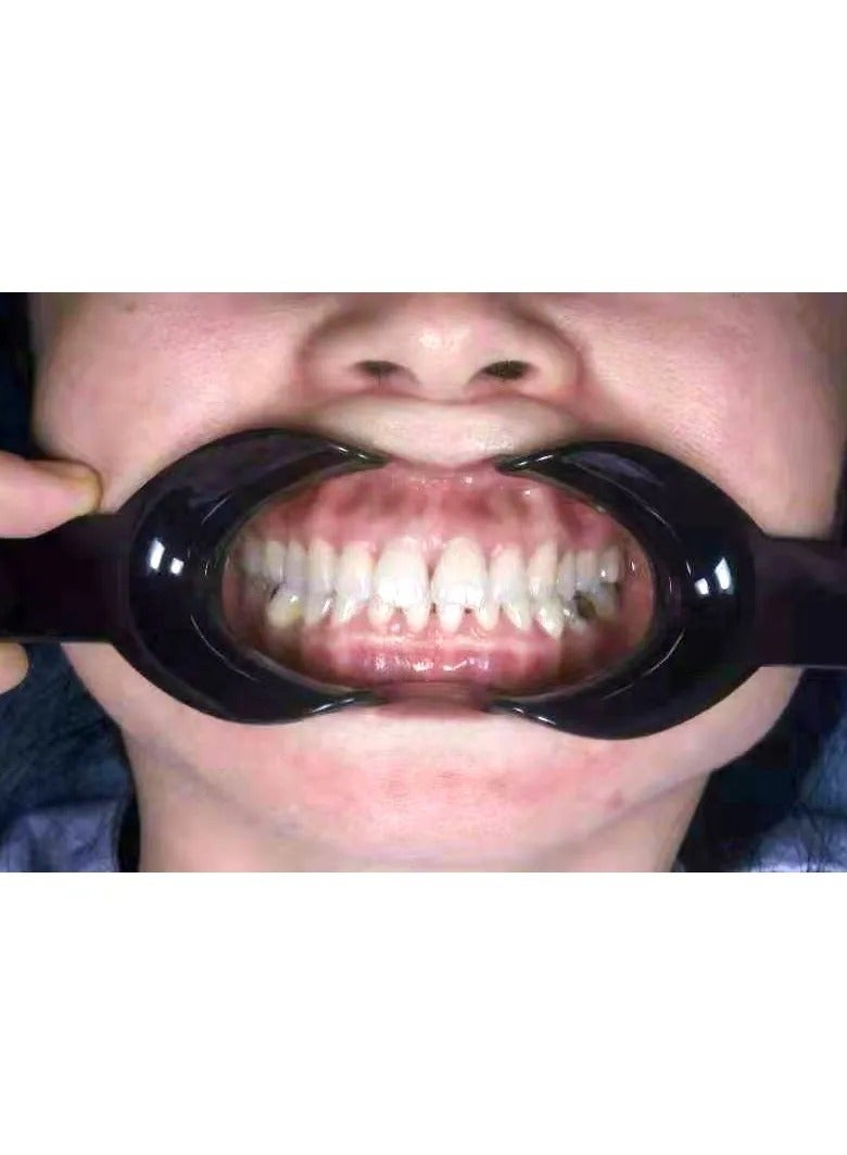 AROAQ Dental Cheek Retractor, Durable Dental Orthodontic Mouth Opener, Easy To Use T Shape Intraoral Cheek Lip Retractor Opener, Double Head Mouth Opener Dental Instrument, (2pcs Small And 2pcs Large) - Image 5