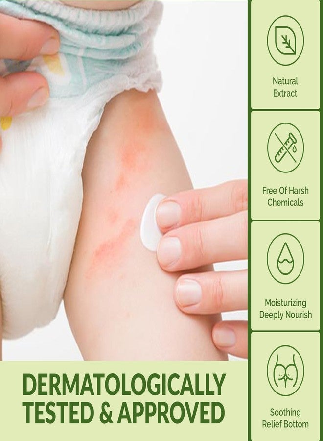 WBM Diaper Rash Cream | Baby Rash Relief Ointments Cream | Cruelty-Free, Hypoallergenic, Soothing, Moisturizing with Zinc Oxide | Gentle for Baby Skin | 2.82 oz - Image 5