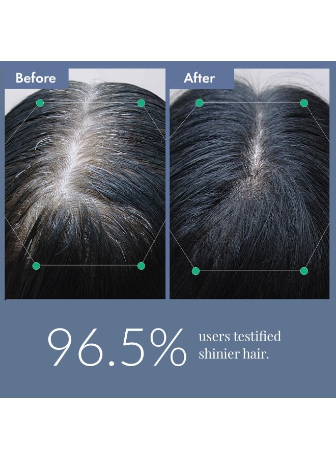 ThriveCo Anti-Grey Hair Prime Serum | Arcolys + Biotin + Black Tea Extract | Light-Weight, Non-Sticky & Odourless | For Men and Women | 50 Ml (Pack of 5) - Image 3