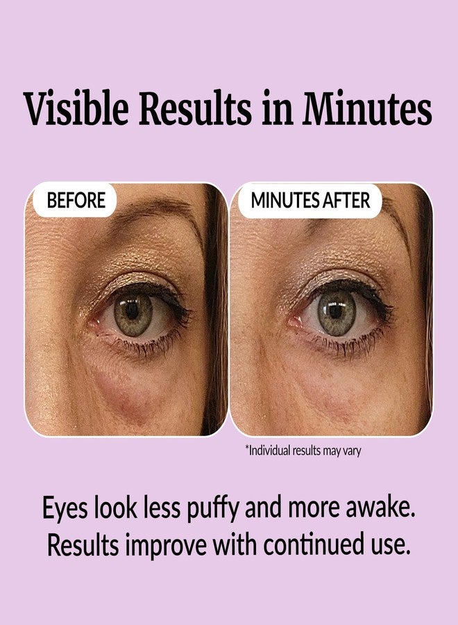 Vibriance Eye Renewal Serum for Mature Skin - Dark Circles, Puffiness & Fine Lines Treatment - 6 Advanced Ingredients with Caffeine & Hyaluronic Acid - Image 4