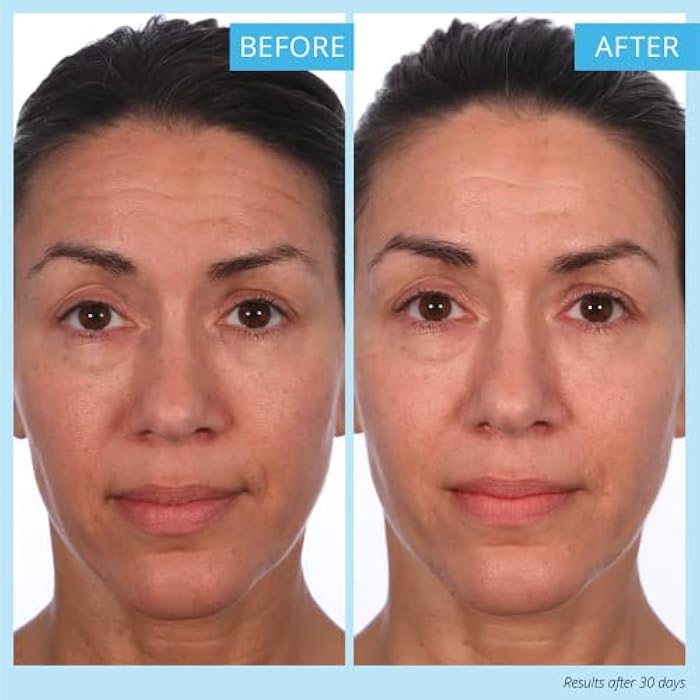 SKINN Crème Reverse with Ferulic Acid, Retinol and Vitamin C-Crème Reverse Intensive-Anti-Aging Cream with Hyaluronic Acid to Plump Skin Vitamin C Help to Improving Tone, Firmness of Skin - Image 4