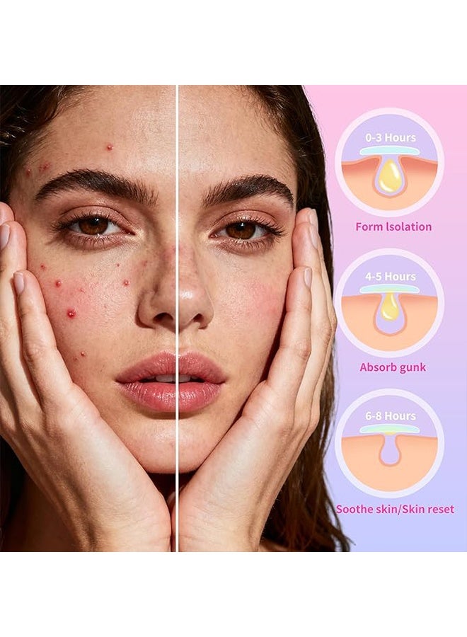 200 رقعة نجمية لعلاج حب الشباب، رقعة نجمية ملونة لطيفة لعلاج حب الشباب، تحتوي على مادة الهيدروكولويد وزيت شجرة الشاي، وحمض الساليسيليك ومستخلص سيكا - Image 5