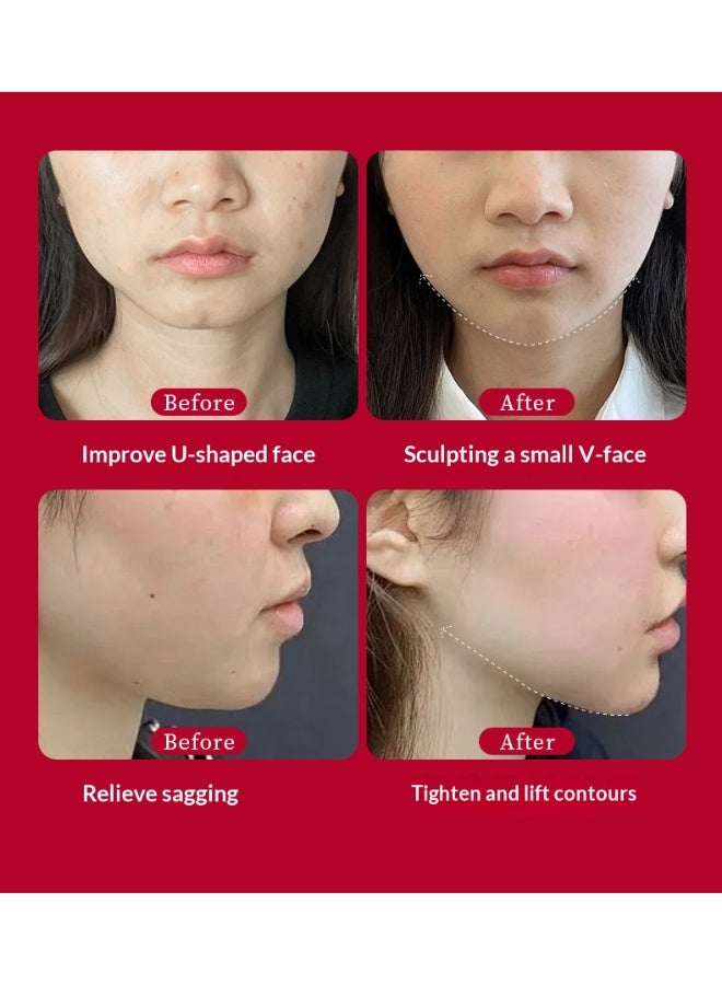 HUNMUI Lifting and Tightening Collagen Mask - V Line Lifting Mask for Chin and Jawline, Double Chin Reducer, Skin Tightening & Moisturizing for All Skin Types - Image 5