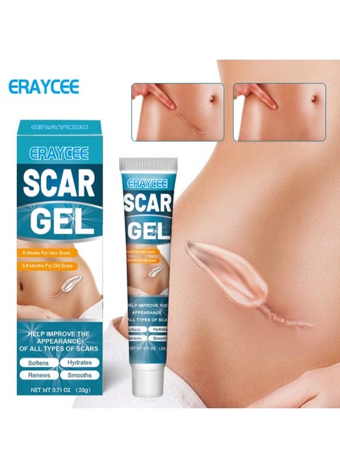 Scar Gel 20g Effective In Treating Scars C-Section Scars Stretch Marks Acne Surgery Burns Effective On Old And New Scars