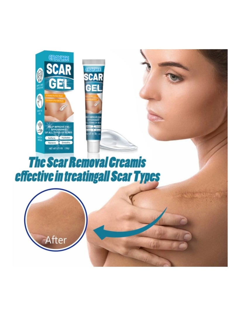 Scar Gel 20g Effective In Treating Scars C-Section Scars Stretch Marks Acne Surgery Burns Effective On Old And New Scars