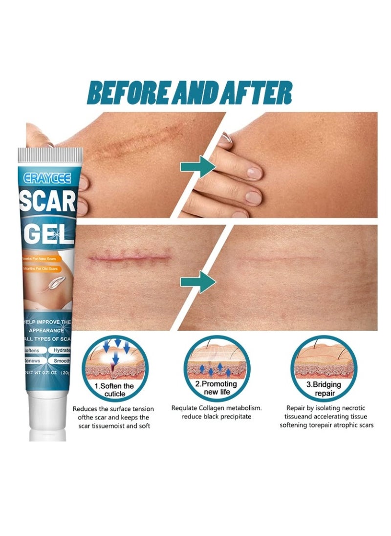 Scar Gel 20g Effective In Treating Scars C-Section Scars Stretch Marks Acne Surgery Burns Effective On Old And New Scars