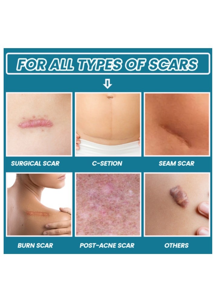 Scar Gel 20g Effective In Treating Scars C-Section Scars Stretch Marks Acne Surgery Burns Effective On Old And New Scars