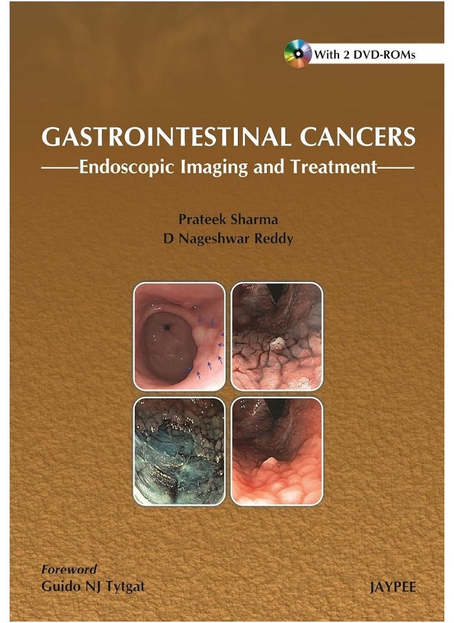 Gastrointestinal Cancers:: Endoscopic Imaging and Treatment 