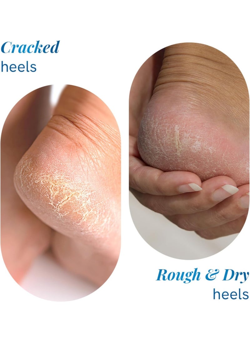 Be Bodywise 20% Urea Foot Cream Roll On | Repairs Dry & Cracked Heels | 2% Lactic Acid, Olive Oil & Vitamin E I Exfoliates & Softens Skin I Hydrates & Moisturises INo Irritation IAll Skin TypesI 50 ml - Image 2