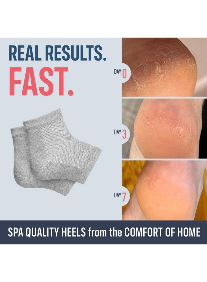 Dr. Frederick's Original Moisturizing Heel Socks For Cracked Heel Treatment 2 Pairs Stop Cracked Heels In Their Tracks - Image 2