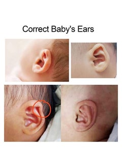 Generic Infant Silicone Auricle Correction Patch, Aesthetic Corrector For Babies Newborn Kids With Protruding Ears 4 x 100cm  - Image 3
