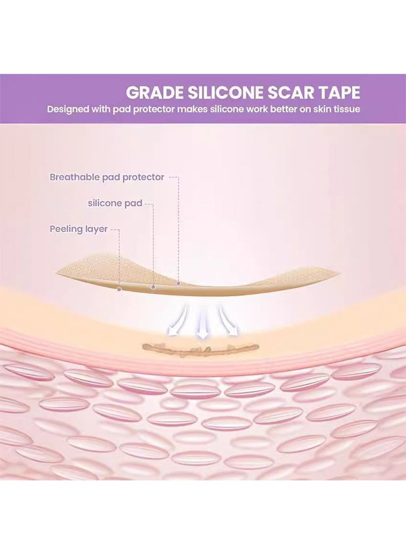 Generic Silicone Scar Sheets, Reusable Professional Scar Removal Strips for C-Section, Surgery, Burn, Acne W4cm*L3m  - Image 3