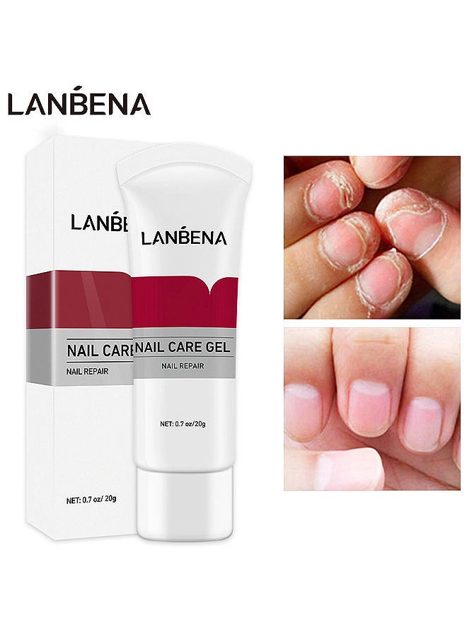 Nail Care Gel, Nail Repair, Nail Repair Cream To Restore The Appearance Of Discolored Or Damaged Nails (20g)