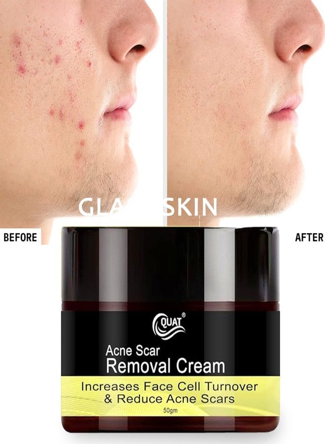Quat Acne Scar Removal Cream 50g | Reduces Dark Spots, Blemishes & Pimple Marks | Smoothes Skin Texture | Spot Correction & Brightening Formula for Clear, Even-Toned Skin - Image 1
