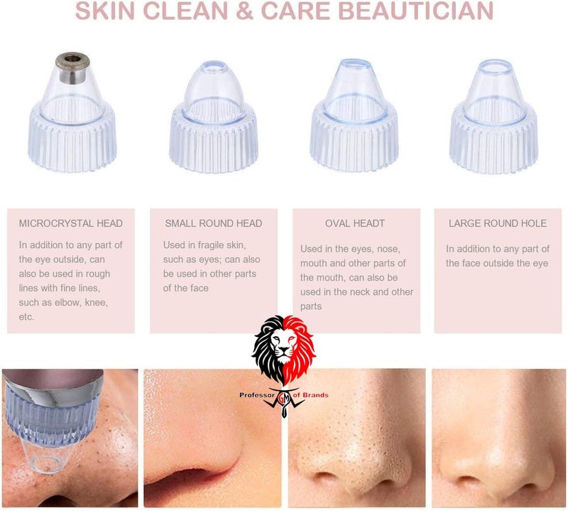 Vacuum Suction Pore Cleaner, 4 Interchangeable Heads, Blackhead and Impurity Removal, Rechargeable with USB Cable - Image 3